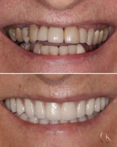 Resultados Dra Candida - 01