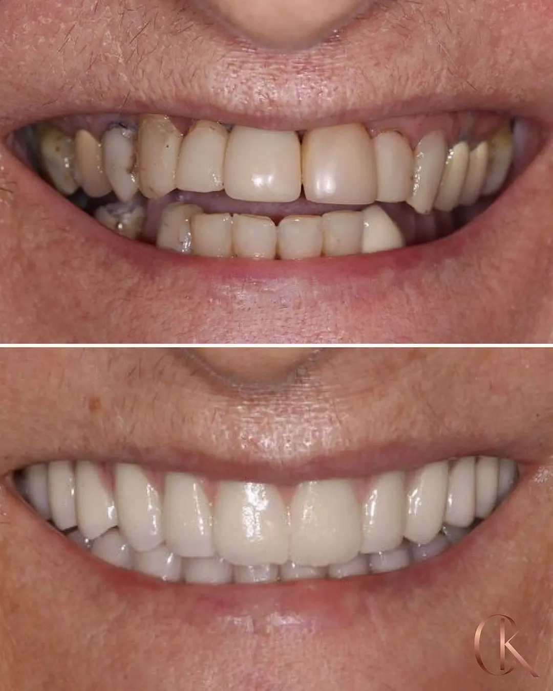 Resultados Dra Candida - 01