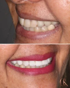 Resultados Dra Candida - 02