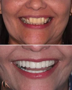 Resultados Dra Candida - 03