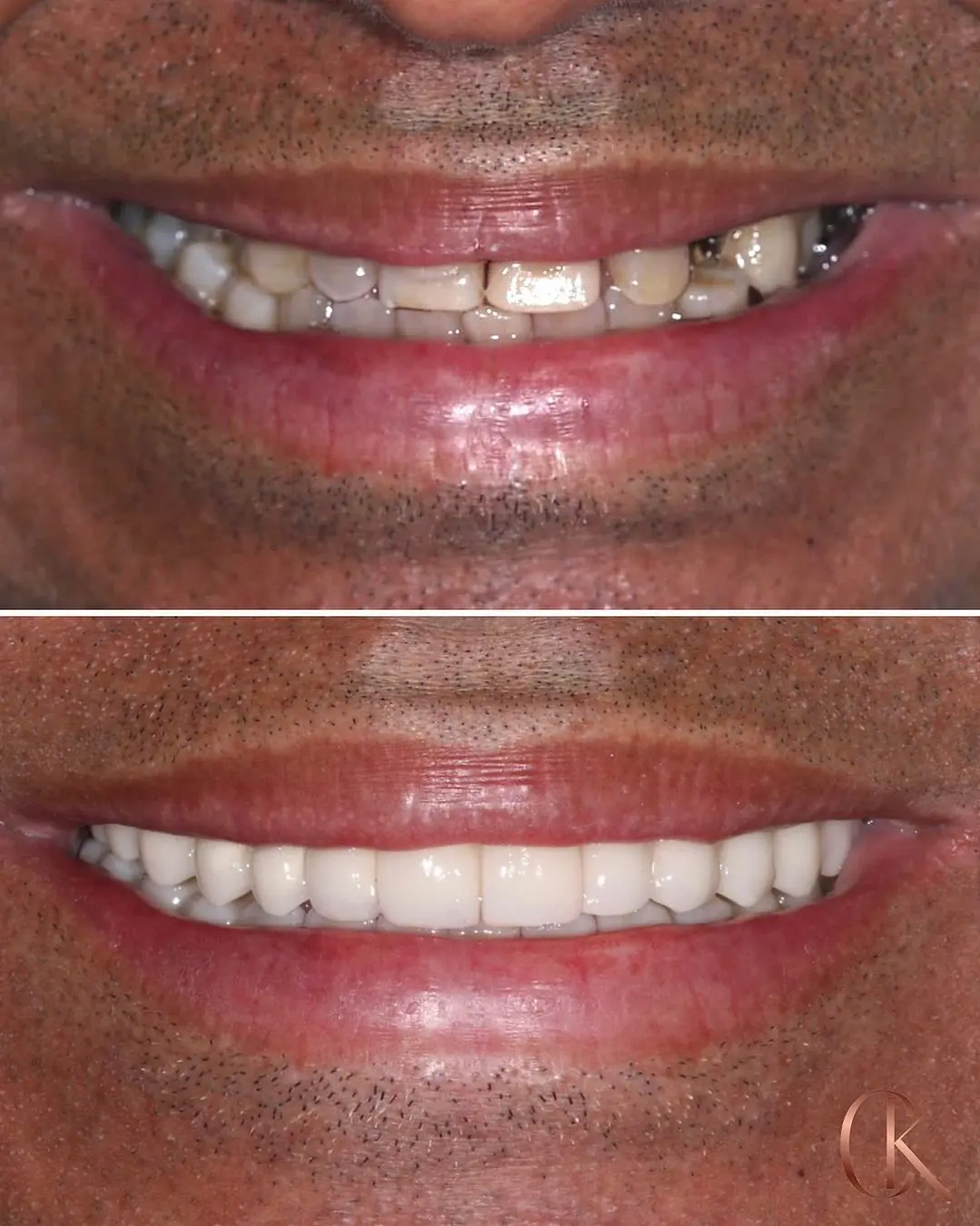 Resultados Dra Candida - 04