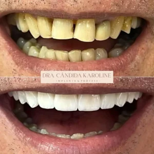 Do amarelado ao branquíssimo!