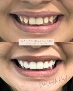 Resultados Dra Candida - 07